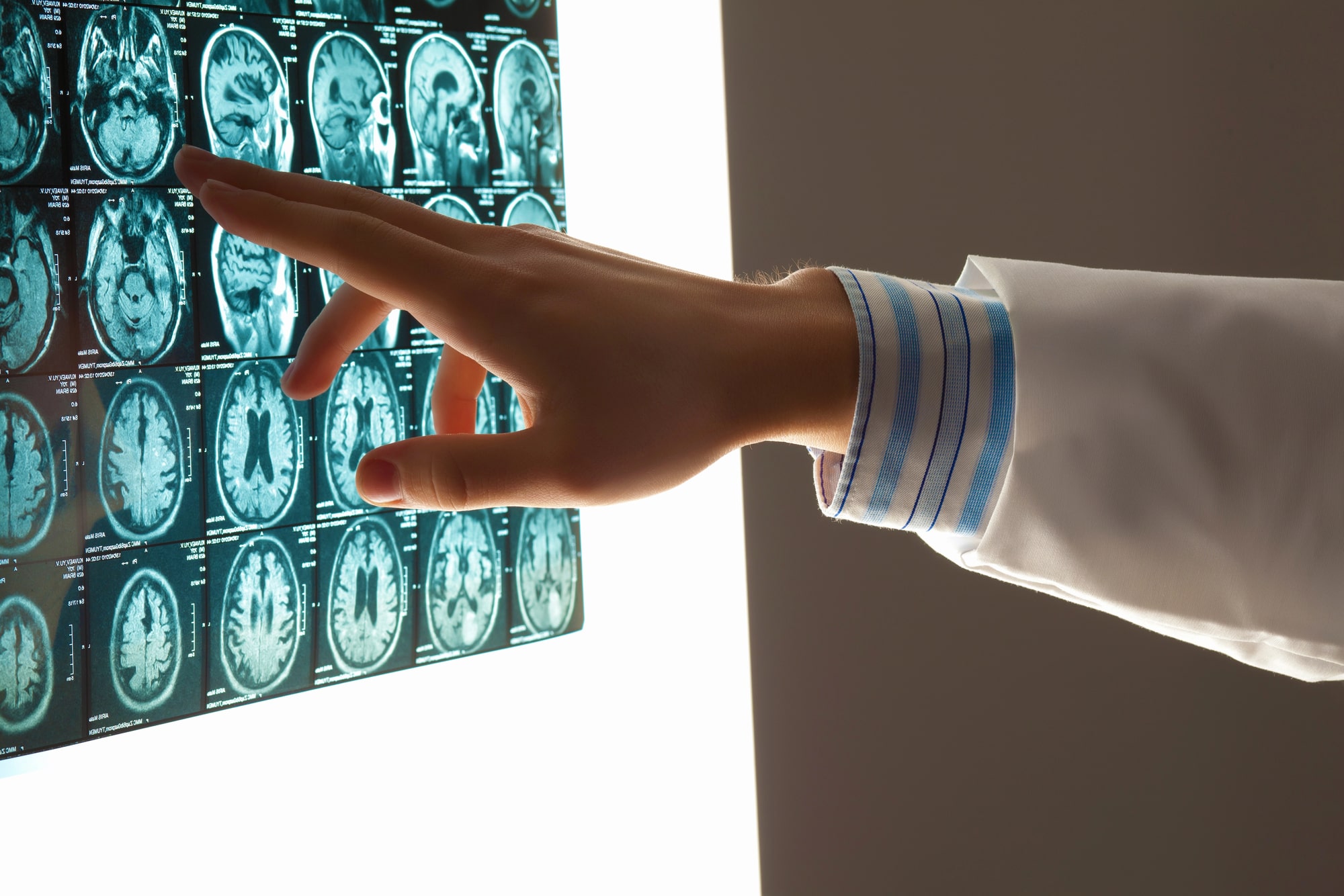 workplace brain injury lawyer New Mexico